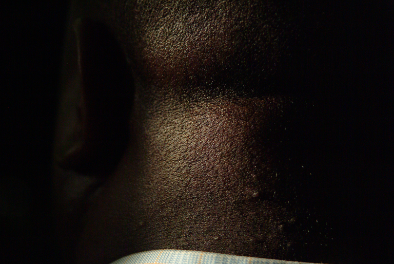 Skin Texture